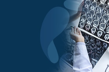 Trombose Venosa Cerebral: diagnóstico e tratamento | Dr. Iago Navas