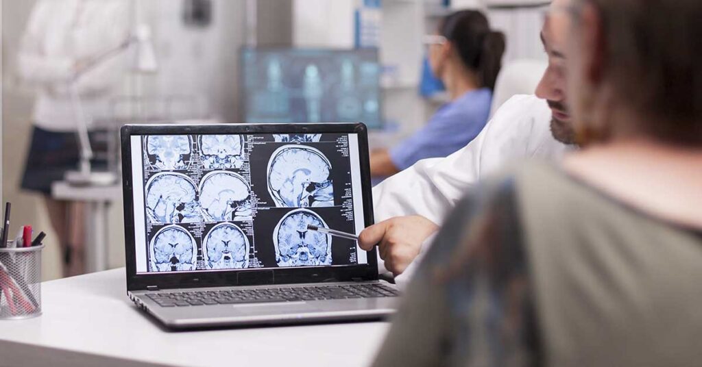 Neurologista especialista em AVC em São Paulo